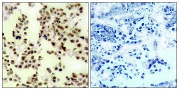 p73 (phospho Tyr99) rabbit pAb Antibody