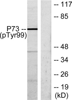 p73 (phospho Tyr99) rabbit pAb Antibody