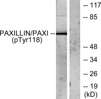 Paxillin (phospho Tyr118) rabbit pAb Antibody