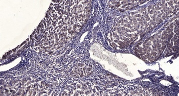 Paxillin (phospho Tyr88) rabbit pAb Antibody