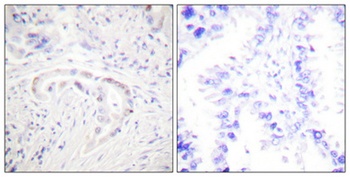 PKC ζ (phospho Thr410) rabbit pAb Antibody