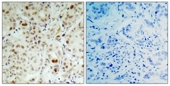 Rb (phospho Ser807) rabbit pAb Antibody