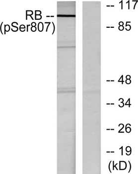 Rb (phospho Ser807) rabbit pAb Antibody