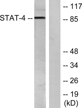 Stat4 (phospho Tyr693) rabbit pAb Antibody