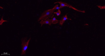 Tau (phospho Ser396) rabbit pAb Antibody