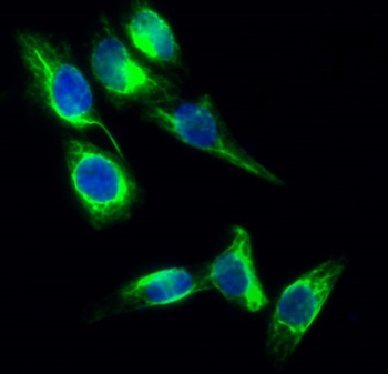 Tau (phospho Ser396) rabbit pAb Antibody