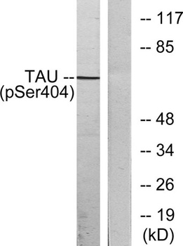 Tau (phospho Ser404) rabbit pAb Antibody