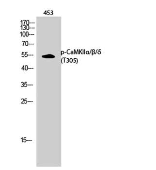 CaMKIIα/β/δ (phospho Thr305) rabbit pAb Antibody