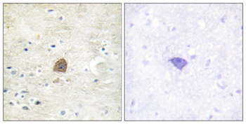 CaMKIIα/β/δ (phospho Thr305) rabbit pAb Antibody