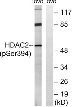 HDAC2 (phospho Ser394) rabbit pAb Antibody