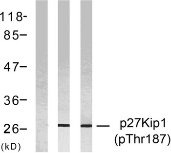 p27 (phospho Thr187) rabbit pAb Antibody