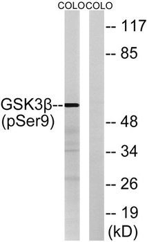 GSK3β (phospho Ser9) rabbit pAb Antibody