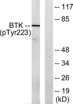 Btk (phospho Tyr223) rabbit pAb Antibody