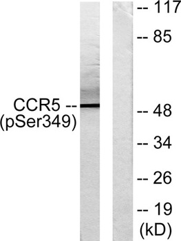 CKR-5 (phospho Ser349) rabbit pAb