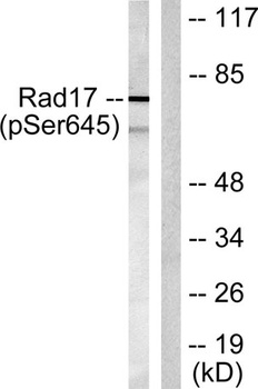 Rad17 (phospho Ser645) rabbit pAb Antibody