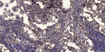 Rad17 (phospho Ser645) rabbit pAb Antibody