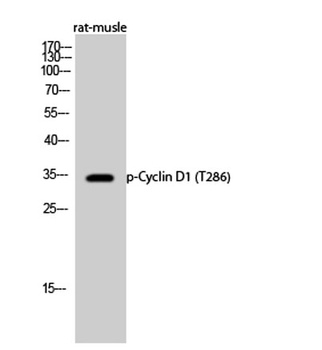 Cyclin D1 (phospho Thr286) rabbit pAb Antibody