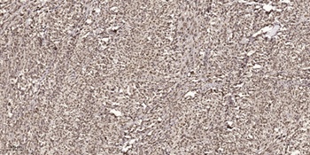 Cyclin D1 (phospho Thr286) rabbit pAb Antibody