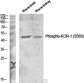 KOR-1 (phospho Ser369) rabbit pAb Antibody