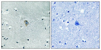 KOR-1 (phospho Ser369) rabbit pAb Antibody