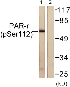 PPAR-γ (phospho Ser112) rabbit pAb Antibody