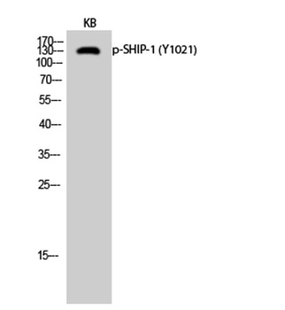 SHIP-1 (phospho Tyr1021) rabbit pAb Antibody