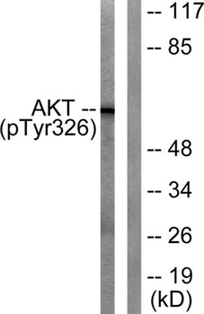 Akt (phospho Tyr326) rabbit pAb Antibody