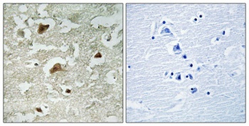 Smad3 (phospho Ser204) rabbit pAb Antibody