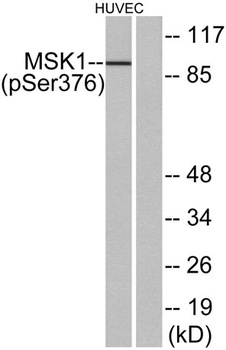 MSK1 (phospho Ser376) rabbit pAb Antibody