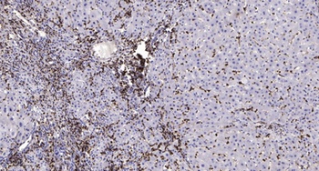 MSK1 (phospho Ser376) rabbit pAb Antibody