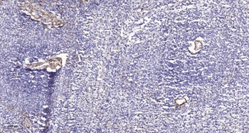 Integrin β3 (phospho Tyr785) rabbit pAb Antibody