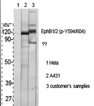 EphB1/2 (phospho Tyr594/604) rabbit pAb Antibody
