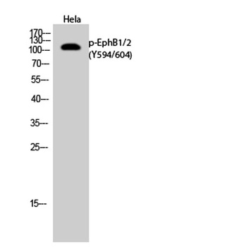 EphB1/2 (phospho Tyr594/604) rabbit pAb Antibody