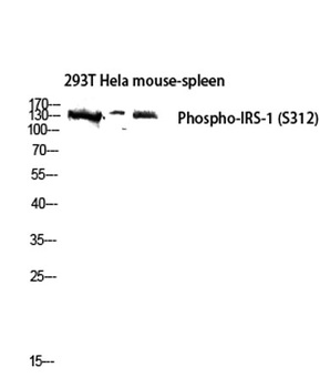 IRS-1 (phospho Ser312) rabbit pAb Antibody