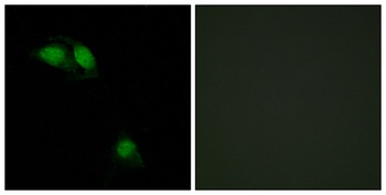 IRS-1 (phospho Ser312) rabbit pAb Antibody