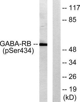 GABAA Rβ1 (phospho Ser434) rabbit pAb Antibody