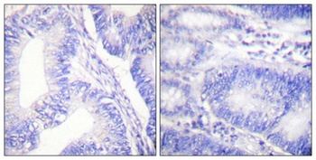 Shc (phospho Tyr427) rabbit pAb Antibody