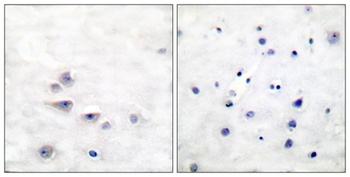 Shc (phospho Tyr427) rabbit pAb Antibody