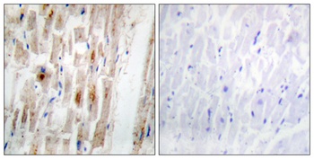 Smad1 (phospho Ser465) rabbit pAb Antibody