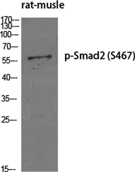 Smad2 (phospho Ser467) rabbit pAb Antibody
