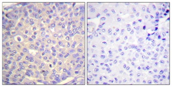 Synaptotagmin 1/2 (phospho Ser309/306) rabbit pAb Antibody