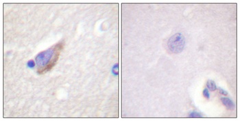 TH (phospho Ser71) rabbit pAb