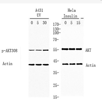 Akt (phospho Thr308) rabbit pAb Antibody