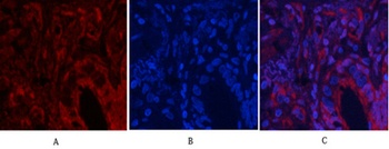 Akt (phospho Thr308) rabbit pAb Antibody