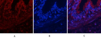 Akt (phospho Thr308) rabbit pAb Antibody