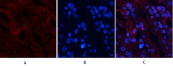 Akt (phospho Thr308) rabbit pAb Antibody