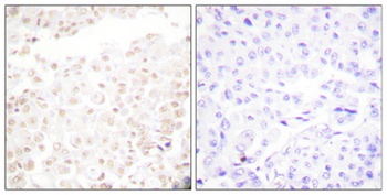 Cdk2/Cdc2 (phospho Thr160) rabbit pAb