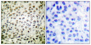 Cdk2/Cdc2 (phospho Thr160) rabbit pAb
