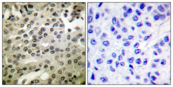 NFκB-p105/p50 (phospho Ser337) rabbit pAb Antibody