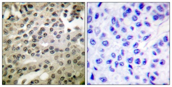 NFκB-p105/p50 (phospho Ser337) rabbit pAb Antibody